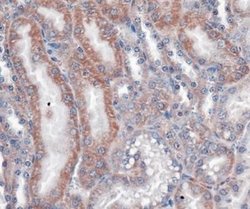 VLDLR Antibody (6A6) - Azide and BSA Free, Novus Biologicals 0.1 mL; Unconjugated:Antibodies,